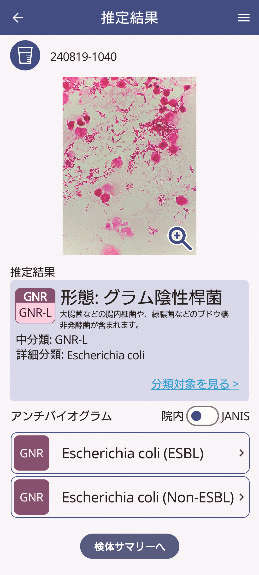 感染症推定AI